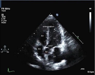 Medirad Diagnostics,best diagnostic center in whitefield,best diagnostic center in kadugodi,best diagnostic center in varthur,best diagnostic center near forum mall,best diagnostic center in forum neighbourhood mall,best diagnostic center in marathahalli,best diagnostic center in channasandra,best diagnostic center in bangalore,varthur,kadugodi,whitefield,top 10 diagnostic center in bangalore,medirad,medirad diagnostic center bangalore