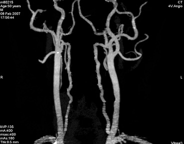 Medirad Diagnostics,best diagnostic center in whitefield,best diagnostic center in kadugodi,best diagnostic center in varthur,best diagnostic center near forum mall,best diagnostic center in forum neighbourhood mall,best diagnostic center in marathahalli,best diagnostic center in channasandra,best diagnostic center in bangalore,varthur,kadugodi,whitefield,top 10 diagnostic center in bangalore,medirad,medirad diagnostic center bangalore