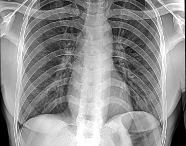 Medirad Diagnostics,best diagnostic center in whitefield,best diagnostic center in kadugodi,best diagnostic center in varthur,best diagnostic center near forum mall,best diagnostic center in forum neighbourhood mall,best diagnostic center in marathahalli,best diagnostic center in channasandra,best diagnostic center in bangalore,varthur,kadugodi,whitefield,top 10 diagnostic center in bangalore,medirad,medirad diagnostic center bangalore